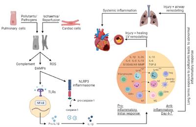 Inflammation as the nexus: exploring the link between acute myocardial infarction and chronic obstructive pulmonary disease